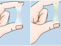 Ra nhiều khí hư khi mang thai tại sao? Cách khắc phục